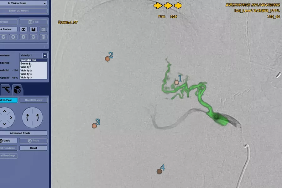 liver-assist-virtual-parenchyma-guide