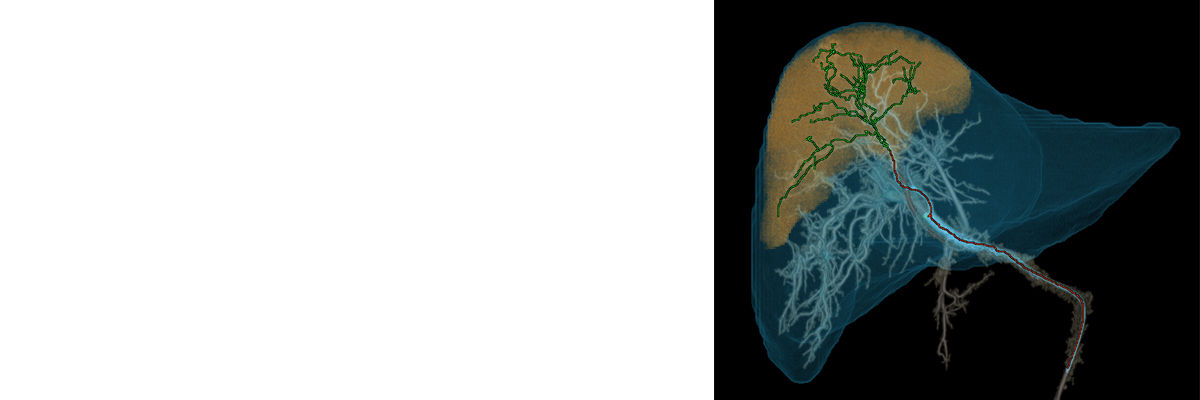 liver-assist-virtual-parenchyma-hero