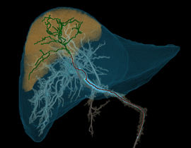 liver-assist-virtual-parenchyma-listing-img