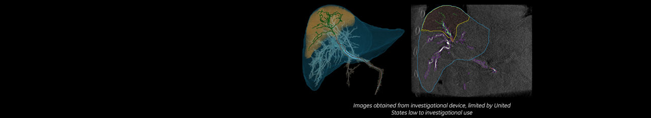 liver-assist-virtual-parenchyma-product-full-width-media