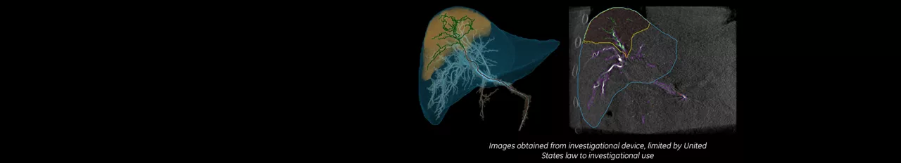 liver-assist-virtual-parenchyma-product-full-width-media