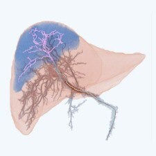 liver-assist-vp-tile-en