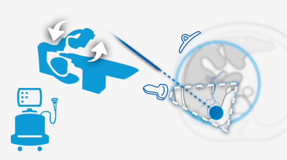 livercare-image-scurve-Interact