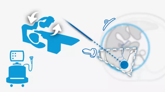 livercare-image-scurve-Interact