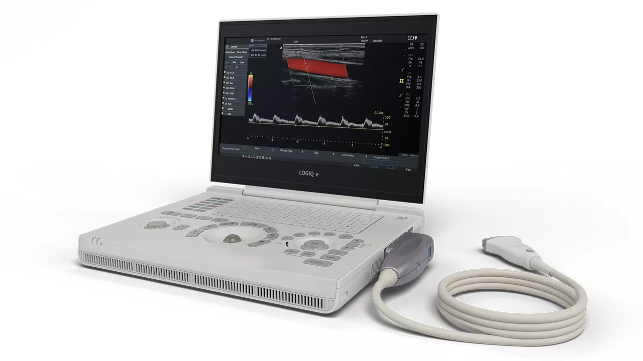 LOGIQ e S laptop ultrasound