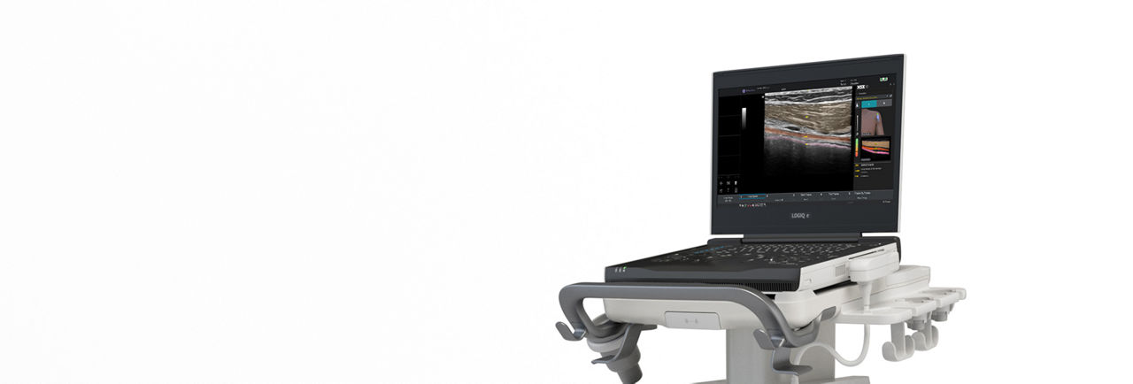 logiq-e-ultrasound-desktop