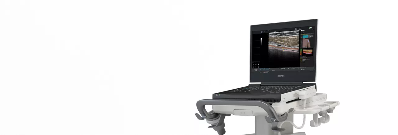 logiq-e-ultrasound-desktop