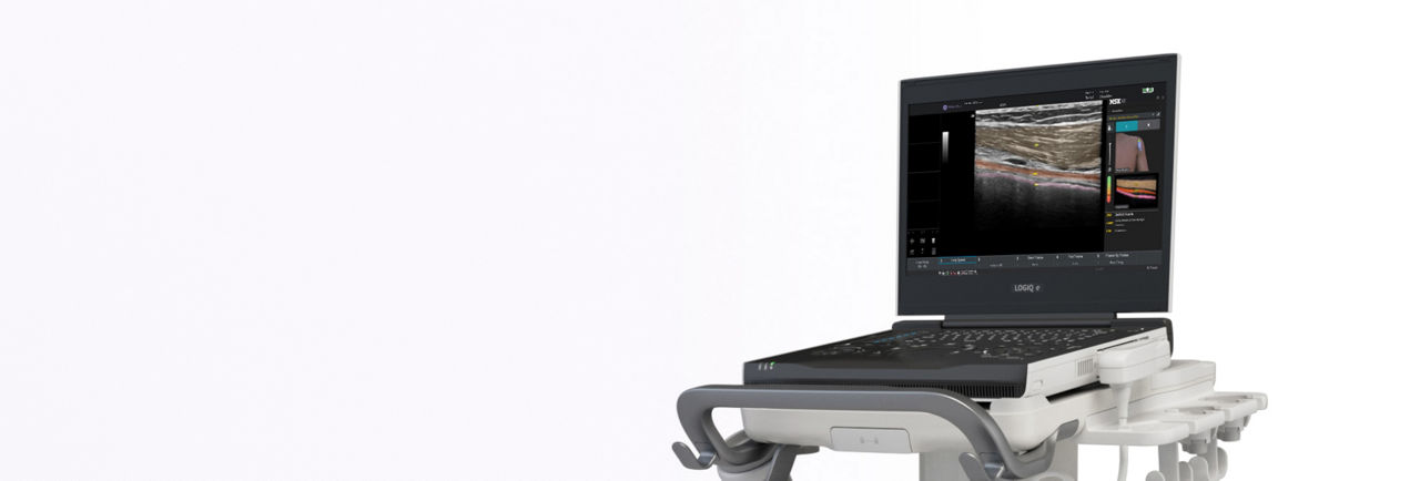 logiq-e-ultrasound-full-w-desktop