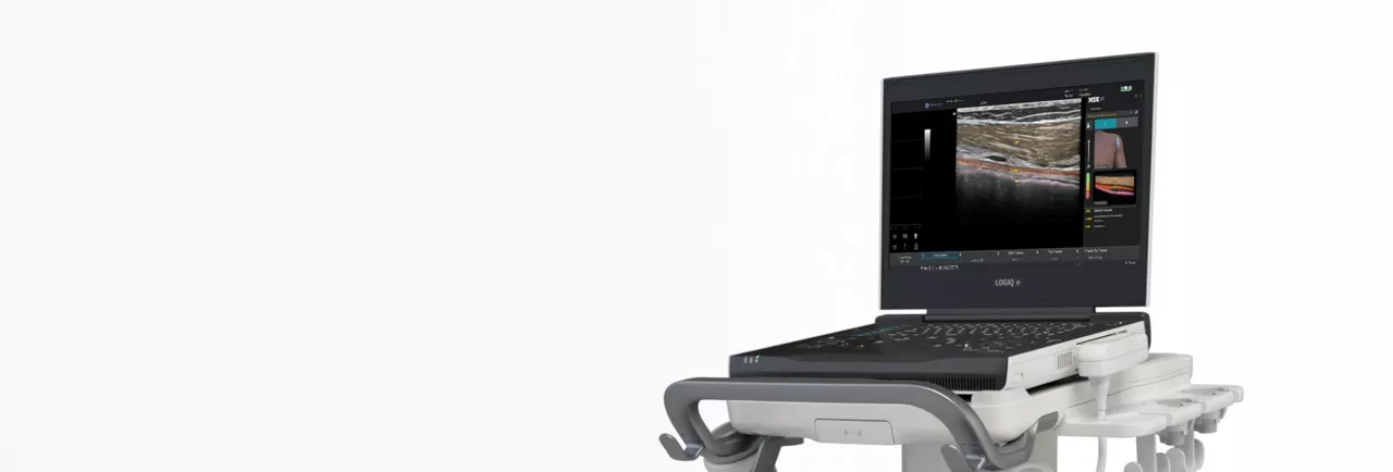 logiq-e-ultrasound-full-w-desktop