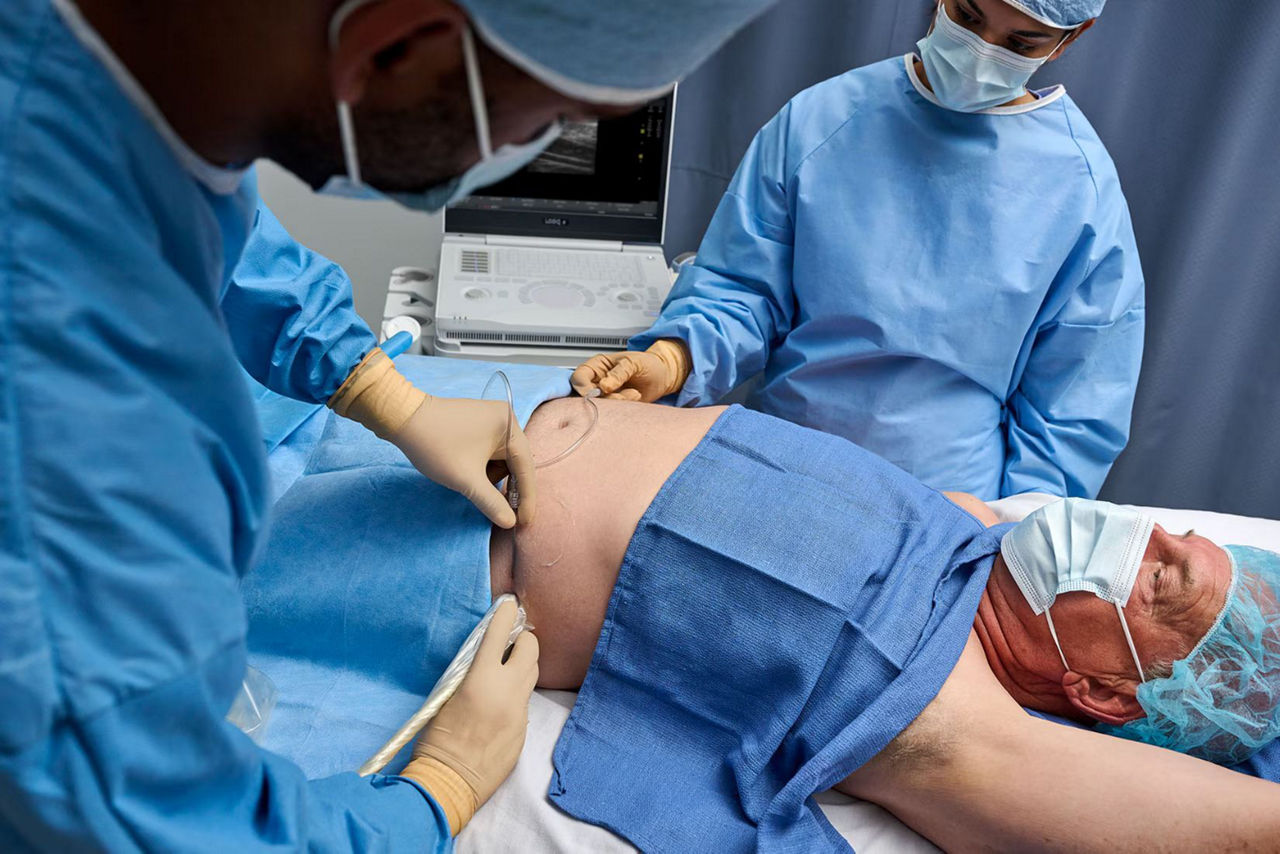 logiq-e-versatility-ba-en.