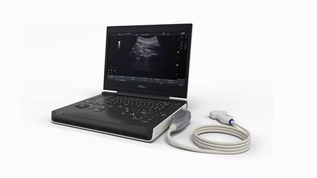 LOGIQ e X laptop ultrasound