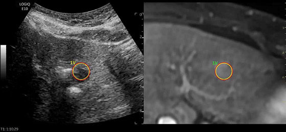 3D GPS/Fusion Imaging