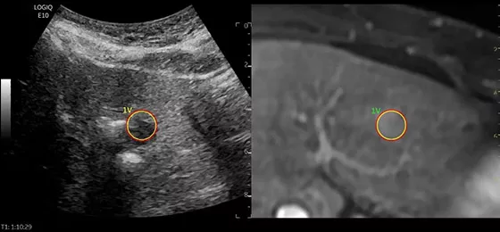 3D GPS/Fusion Imaging