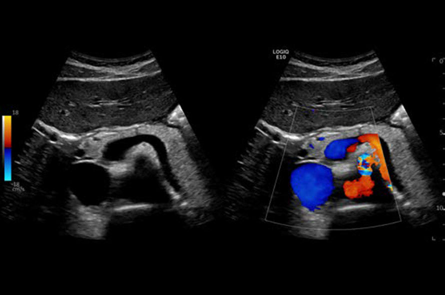 logiq-e10-ge-ultrasound_areas_case02
