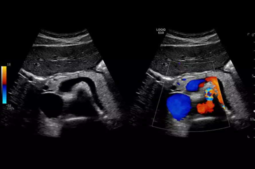 logiq-e10-ge-ultrasound_areas_case02