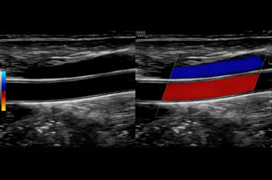 logiq-e10-ge-ultrasound_areas_case07