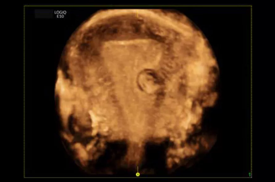logiq-e10-ge-ultrasound_areas_case09