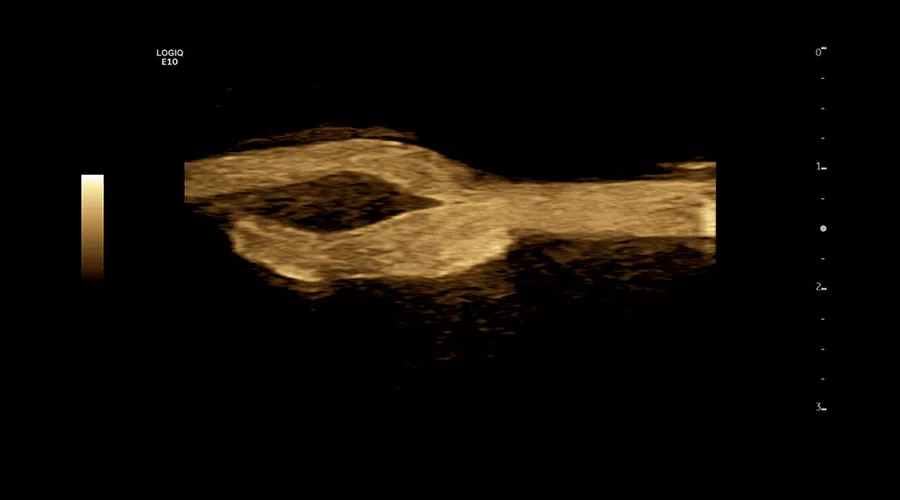 logiq-e10-ge-ultrasound_clinical_case02