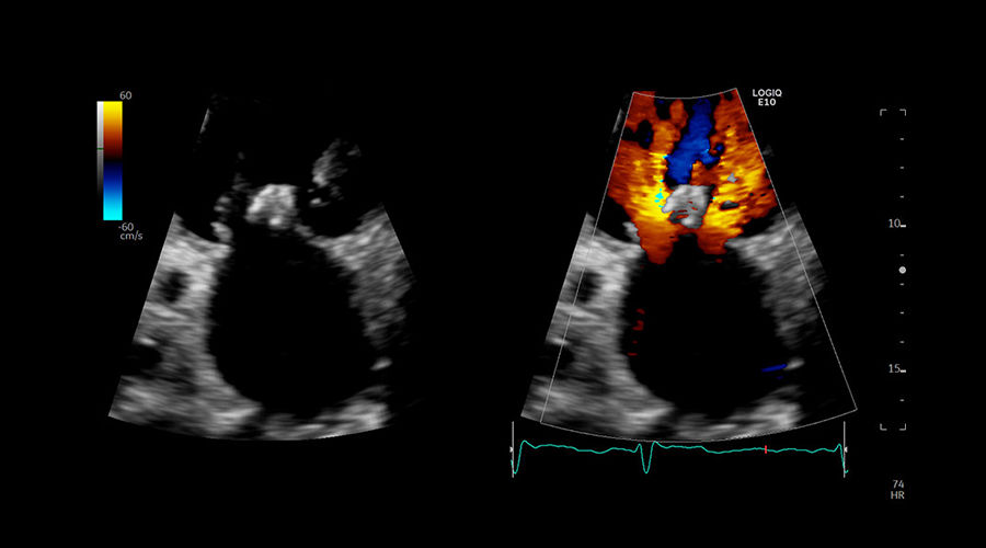 logiq-e10-ge-ultrasound_clinical_case04