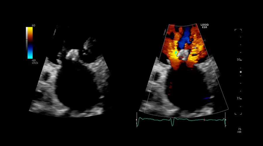 logiq-e10-ge-ultrasound_clinical_case04