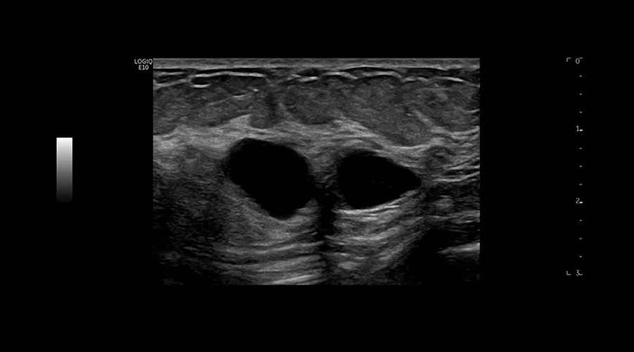 logiq-e10-ge-ultrasound_clinical_case06