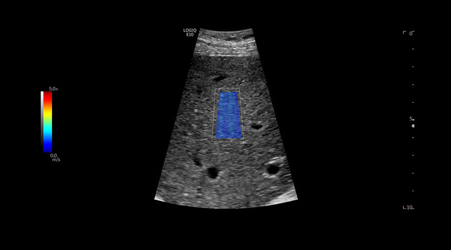 logiq-e10-ge-ultrasound_clinical_case08