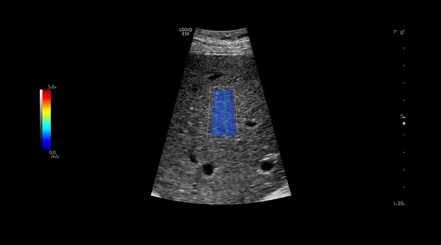 logiq-e10-ge-ultrasound_clinical_case08