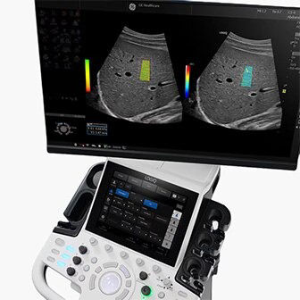 ultrasound logiq p
