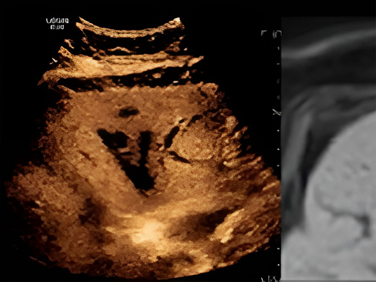 logiq-s8-SCurve5-ci-en