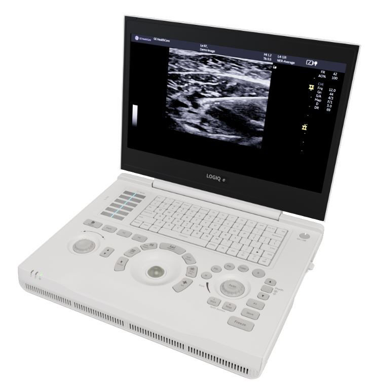 Point of Care Ultrasound 装置 & POCUSソリューション | GE