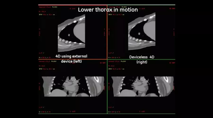 Lower-thorax-in-motion