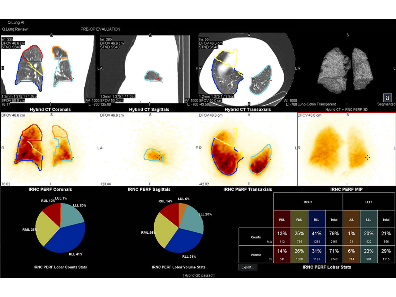 lung-cancer-applications-ArticleHero-ci-en