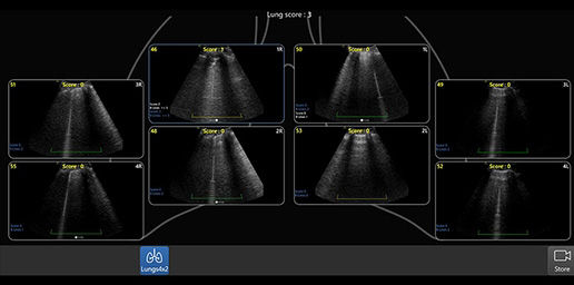 Lung-Diagram-review-cc-desktop
