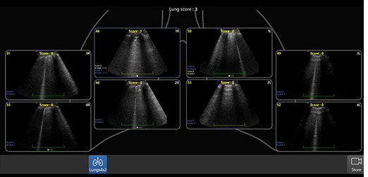 lung-diagram-review-cc-desktop cropped