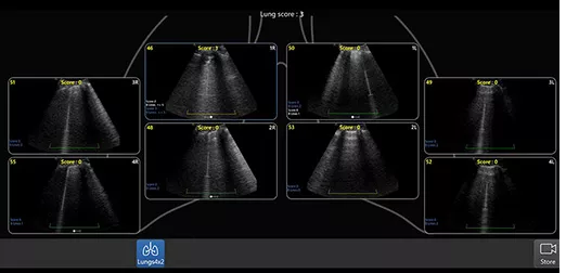 lung-diagram-review-cc-desktop cropped