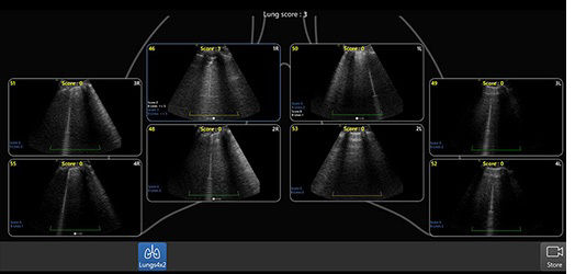 lung-diagram-review-cc-desktop-updated