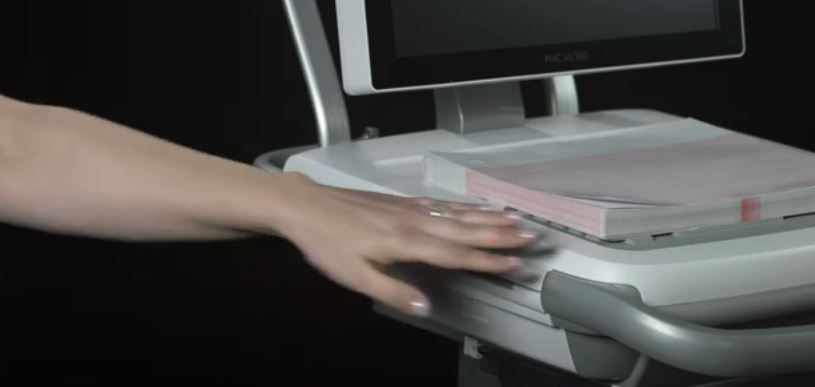 MAC VU360