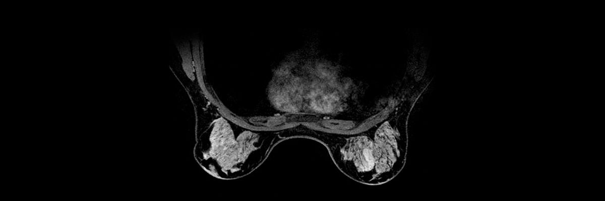 magnetic-resonance-imaging-breast-imaging-vibrant-hero