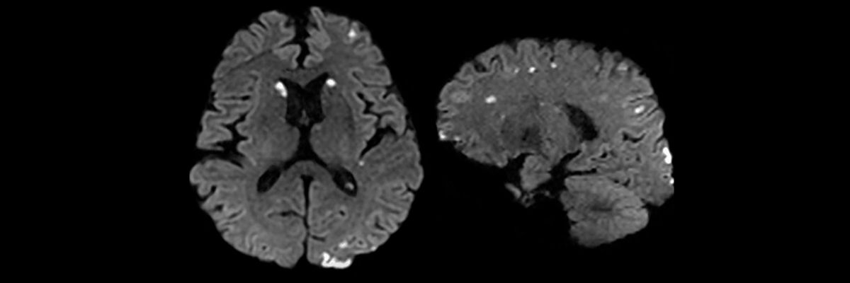 magnetic-resonance-imaging-edwi-banner-image