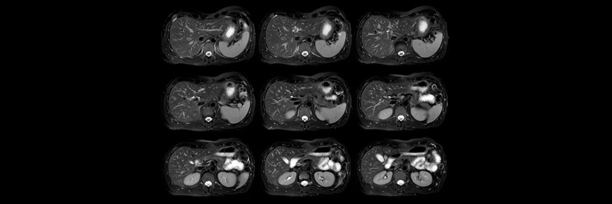 magnetic-resonance-imaging-neuro-imaging-body-propeller-hero