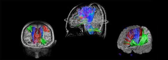 magnetic-resonance-imaging-neuro-imaging-brainwave-neurobrainwave-mobile