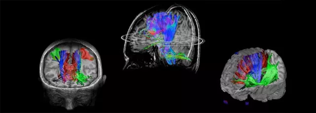 magnetic-resonance-imaging-neuro-imaging-brainwave-neurobrainwave-mobile