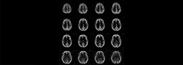magnetic-resonance-imaging-pediatric-imaging-ped-3d-asl-mobile