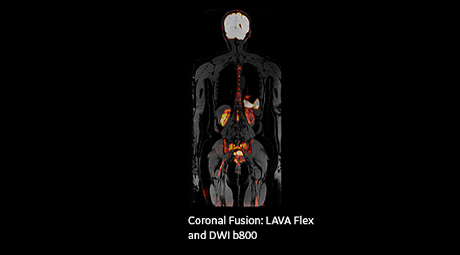 magnetic-resonance-imaging-signapremier-BodyWorks1