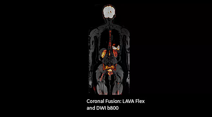 magnetic-resonance-imaging-signapremier-BodyWorks1