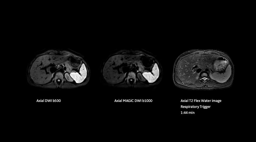 magnetic-resonance-imaging-signapremier-BodyWorks3