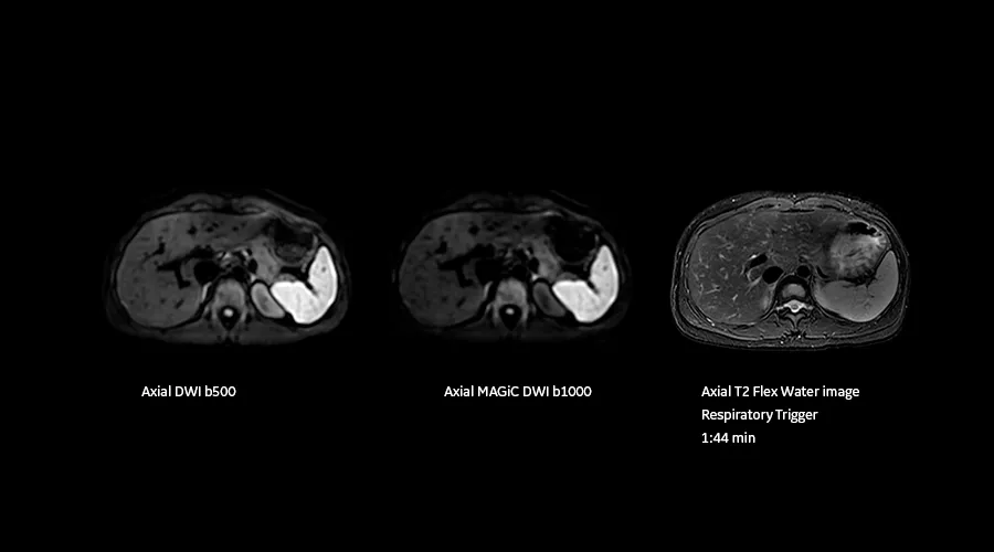 magnetic-resonance-imaging-signapremier-BodyWorks3