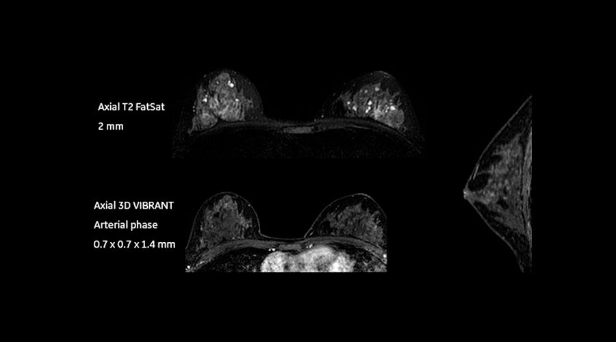 magnetic-resonance-imaging-signapremier-BodyWorks4