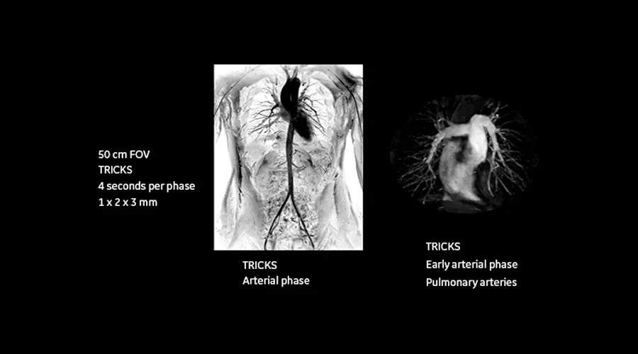magnetic-resonance-imaging-signapremier-CVWorks2