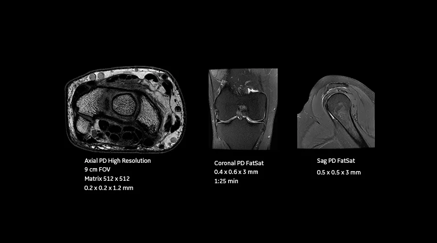 magnetic-resonance-imaging-signapremier-OrthoWorks1